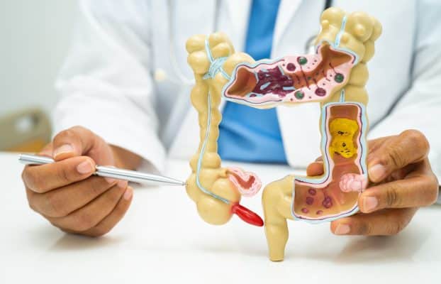 Hospital San Juan de Dios Zapopan, Jalisco 12 CÁNCER DE COLON: UNA ENFERMEDAD SILENCIOSA PERO PREVENIBLE